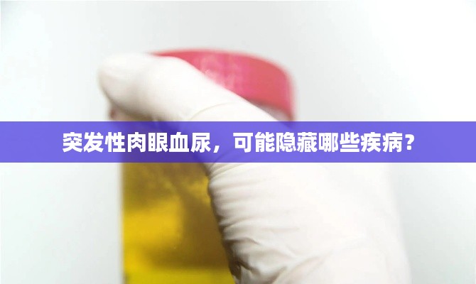突发性肉眼血尿，可能隐藏哪些疾病？